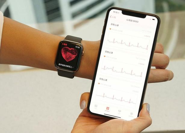 越狱后国行版 Apple Watch 激活 ECG 功能教程