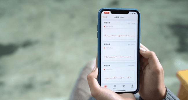 国行版本的 Apple Watch 如何激活使用 ECG 心电图功能？