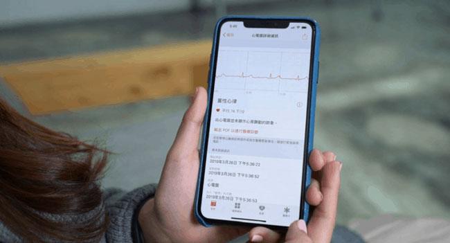 国行版本的 Apple Watch 如何激活使用 ECG 心电图功能？