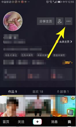 抖音没有消息却有黄点怎么关闭的步骤教程