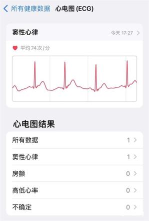 Apple Watch Ultra值得买吗？用后体验分享