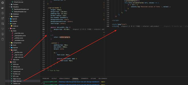 vue 和 scss 结合使用有多少种方式？