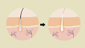 养肾补血方可帮助女性防止脱发
